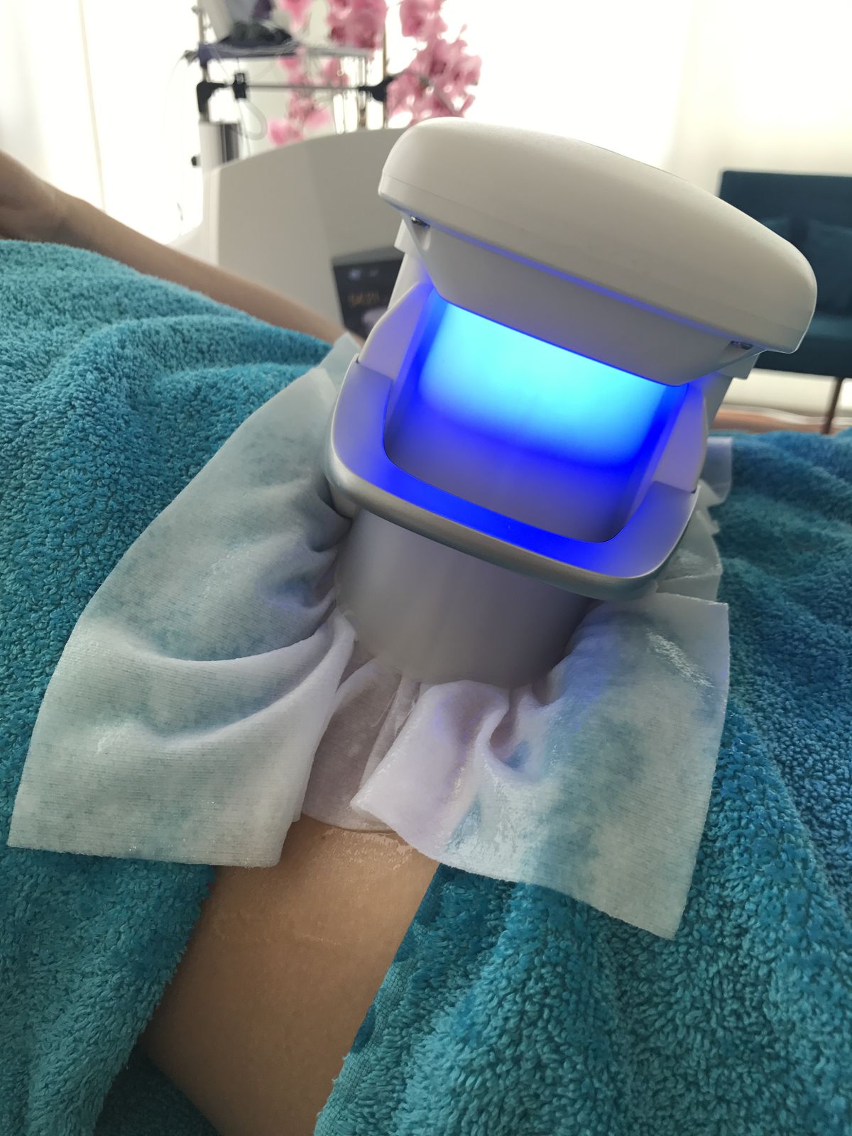 Types de services – Cryolipolyse