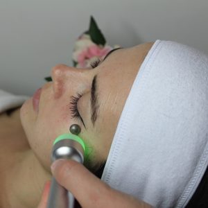 Prestations de Radiofréquence à micro aiguille à Paris